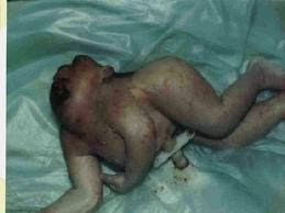 headless bodies of deformed children in Iraq