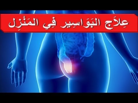 علاج البواسير خلال دقيقتين فقط فى المنزل بكل سهولة