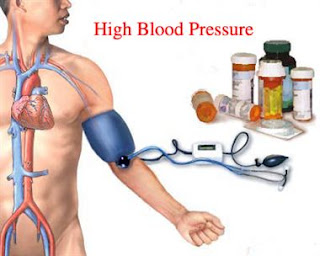  उच्च रक्तचाप, उच्च रक्तचाप के लिए योग, निम्न रक्तचाप के लक्षण, उच्च रक्तचाप के लिए आहार, उच्च रक्तचाप का उपचार, रक्तचाप क्या है, उच्च रक्तचाप की आयुर्वेदिक दवा, उच्च रक्तचाप के लिए घरेलू उपचार, रक्तचाप को नियंत्रित