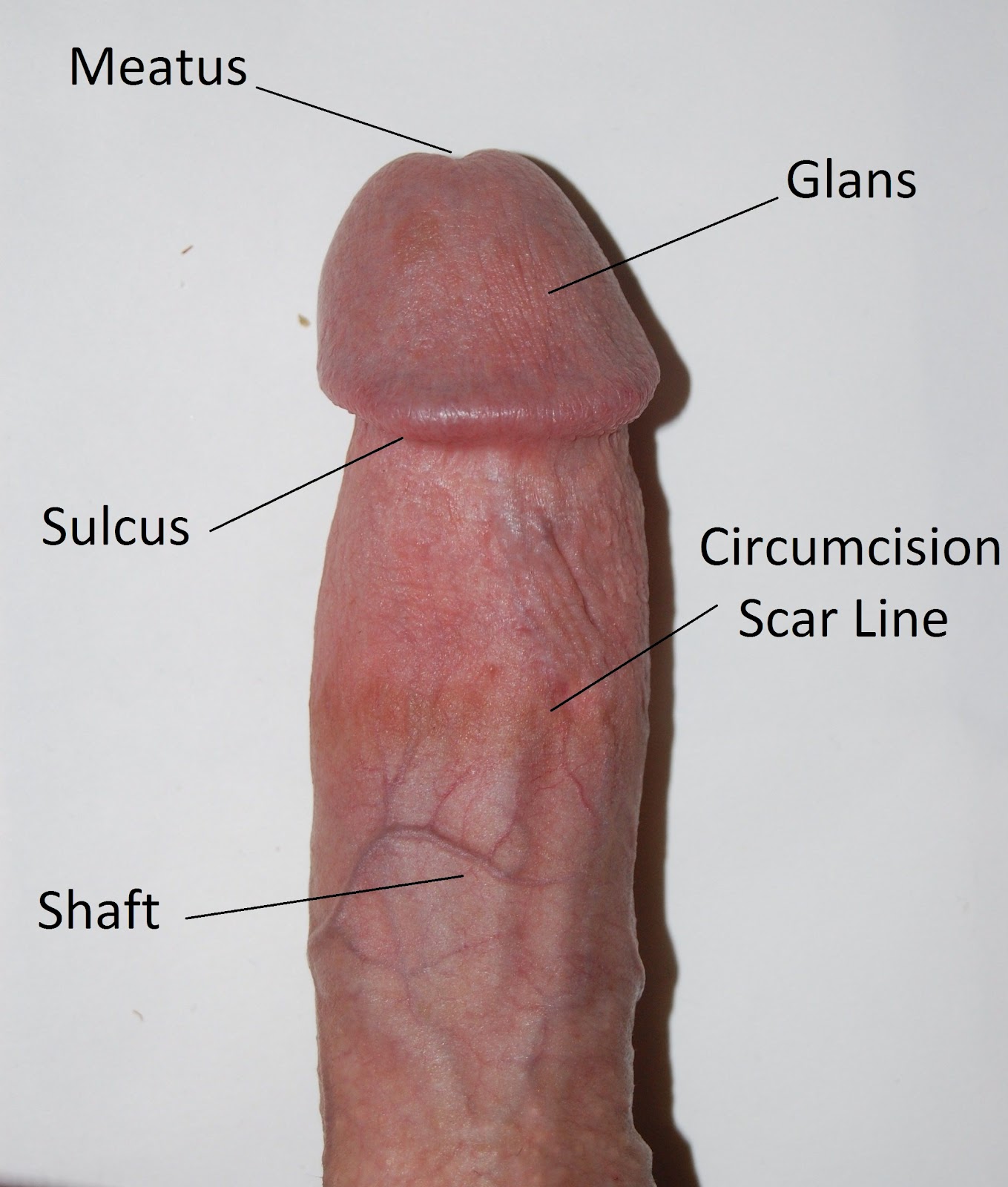 Besarkan Penis 28