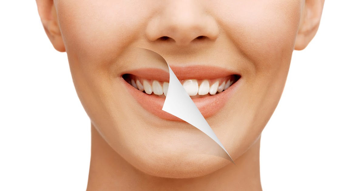 smile-design-makeover-dr-bharat-katarmal-dental-implant-clinic