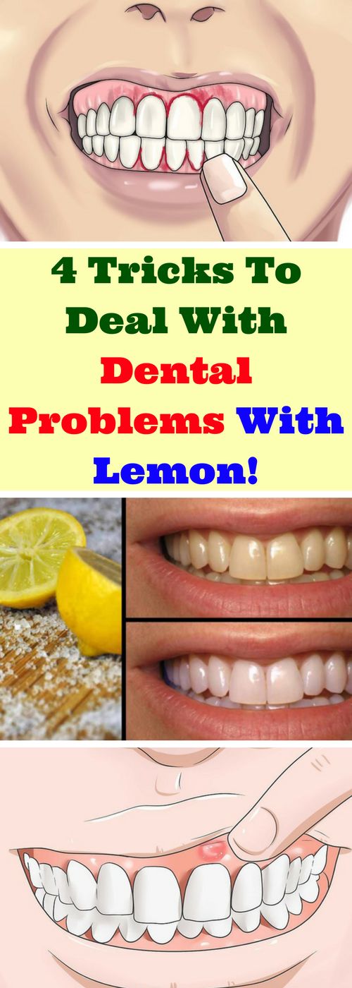 4 Tricks To Deal With Dental Problems With Lemon! healthymasters