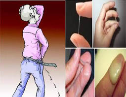 Image Tips ampuh Mengatasi Kemaluan Keluar Lendir Mirip Nanah