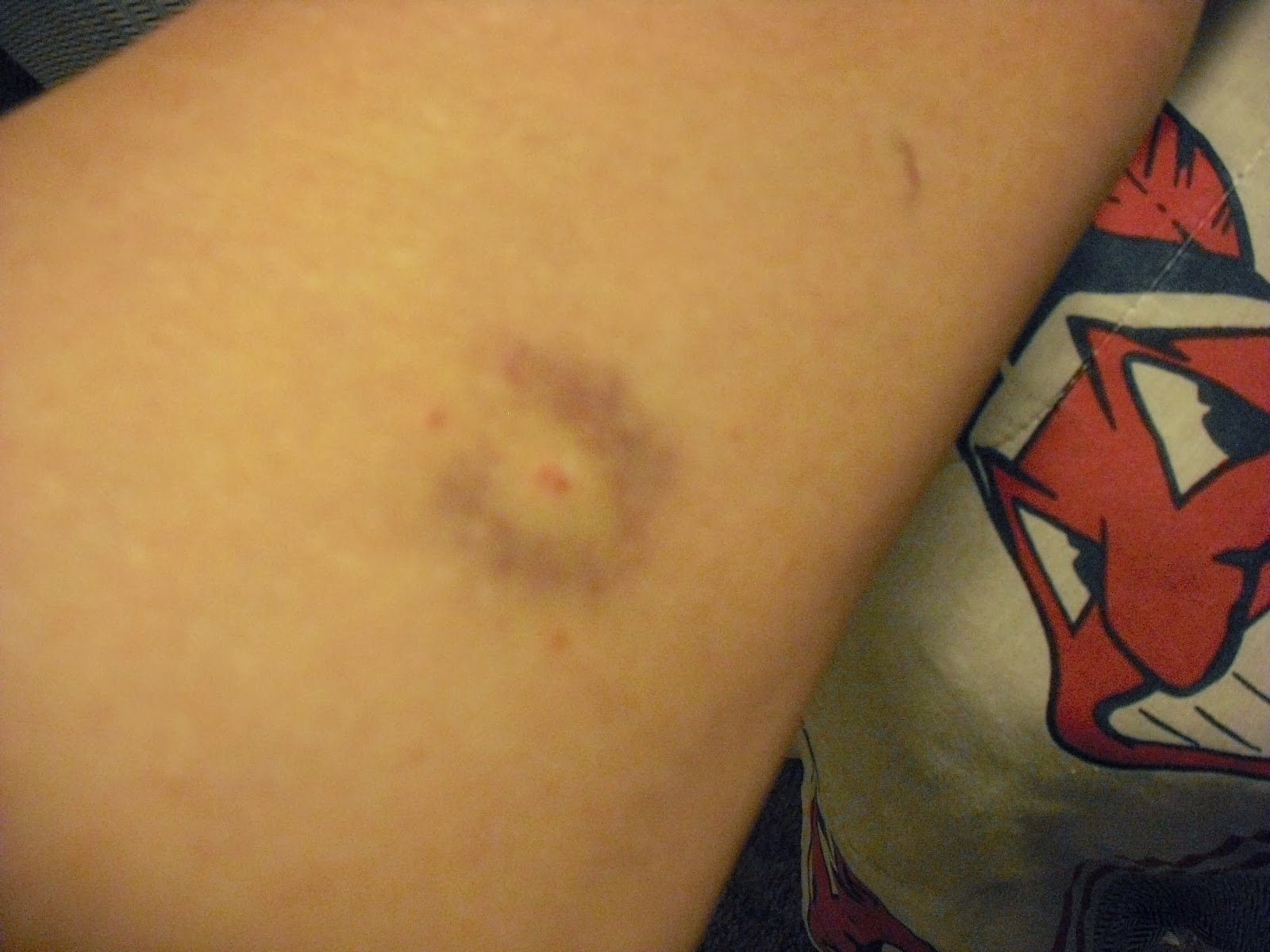 RIGHT WHERE WE BELONG 6 Friday Fragments (New things, food, bruise)