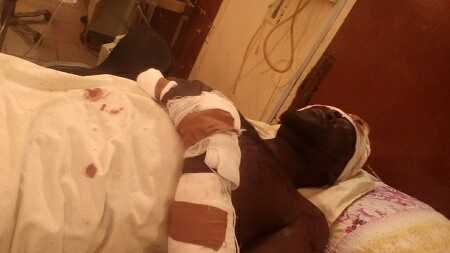 See Survivor of Today's Bomb Blast Receiving Treatment in Borno Hospital
