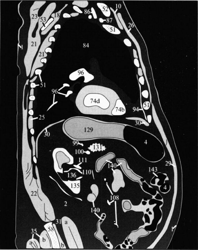 томограмма брюшной полости кт. кт забрюшинного пространства. рентген анатомия брюшной полости на кт. узи и компьютерная томография брюшной полости. томограмма брюшной полости кт.