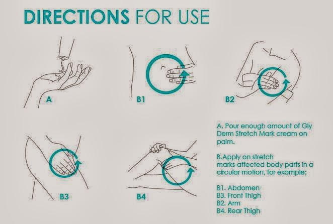 glyderm stretch mark