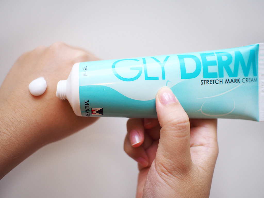 glyderm stretch mark
