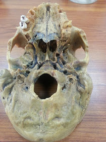 Anatomy Made Easy : Inferior View Of The Skull