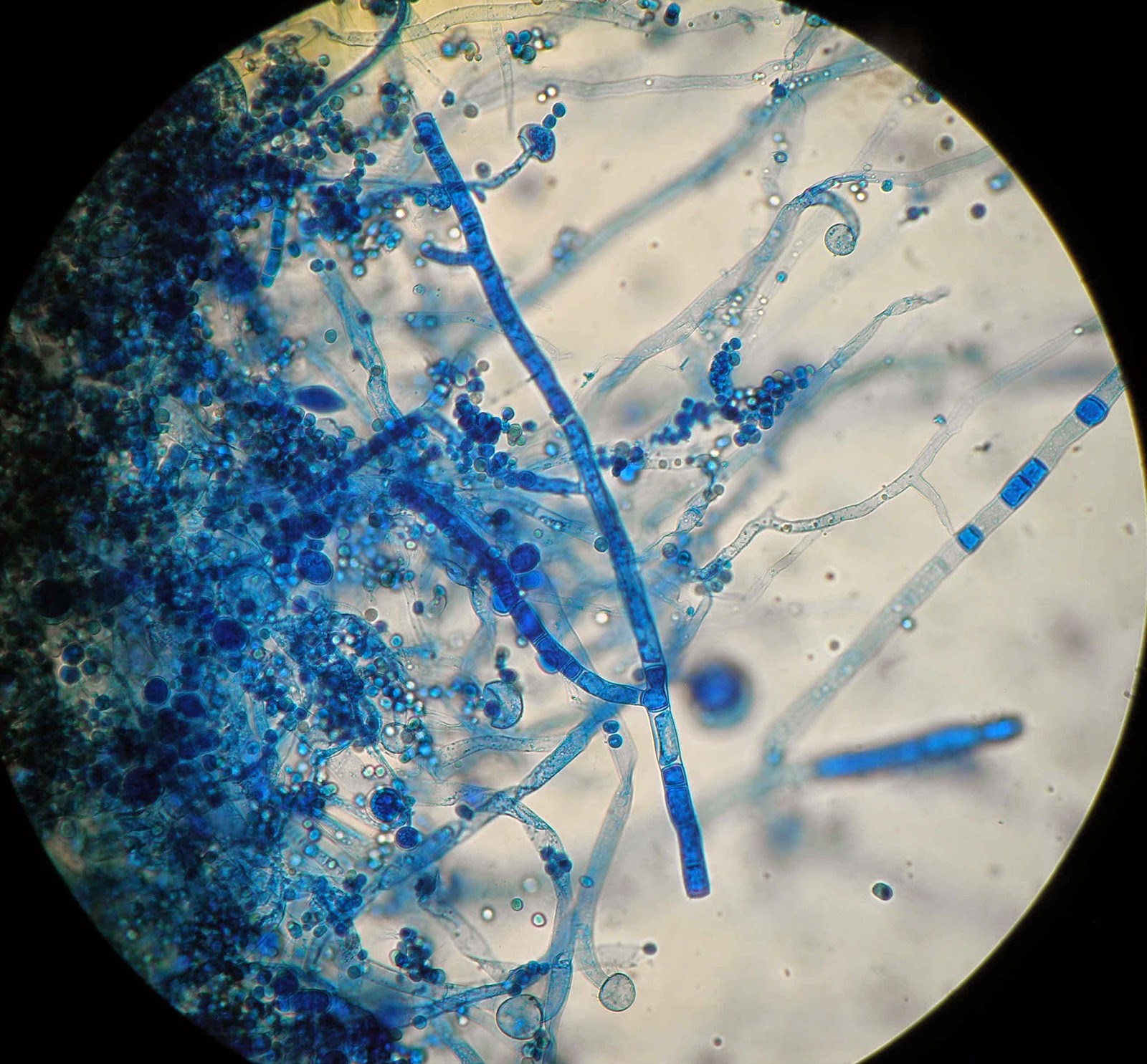 Нити мицелия споры. Мицелий актиномицетов микроскопия. Микробиология Penicillium Aspergillus. Trichophyton микроскопия. Пеницилл микроскопия.