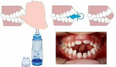 criança pequena,maternidade,jardim de infância,chicachila convencional,jeans,babá,cuidador de criança,algodão,segurança,algodao,chupeta de criança,mamadeira de criança,pediatra