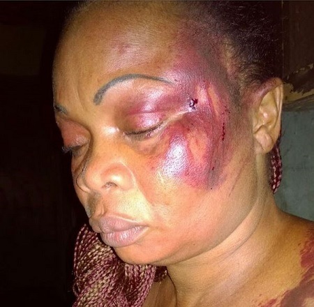 Shocking! See the Way Husband Battered Wife for Becoming Too Proud of Her Business Success (Photo)