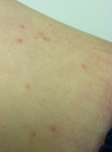 Medical Minstrel: Fam Med II: Rashes & secret code