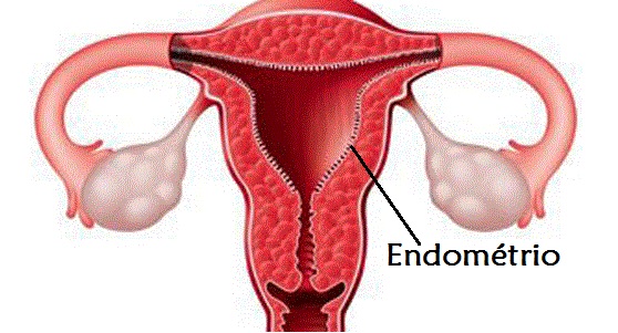 Imagem do endométrio