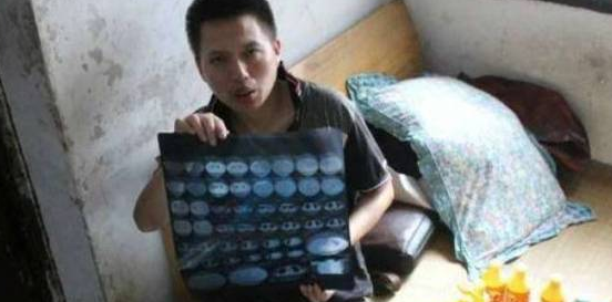 Pria Ini Minum Sampo dan Deterjen Setiap Hari Pria Ini Minum Sampo dan Deterjen Setiap Hari