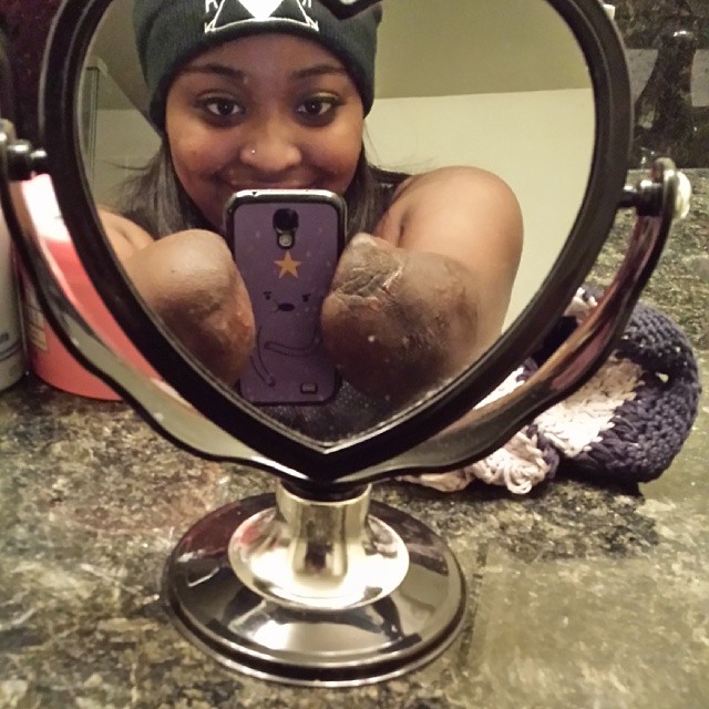 Amputee beautiful girls Princess Eve ! Amputee girls Amputee beautiful girls Princess Eve ! Amputee girls