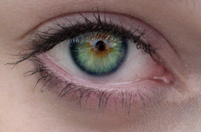 What I Learned from Daniel : The Blog: Central Heterochromia