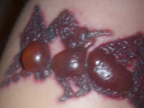 Body Painting Art Gallery and Tattoos: Tattoo Removal