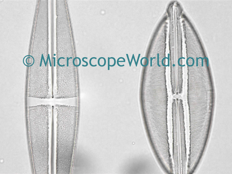 Microscope World Blog Collecting Microscopic Pond Life