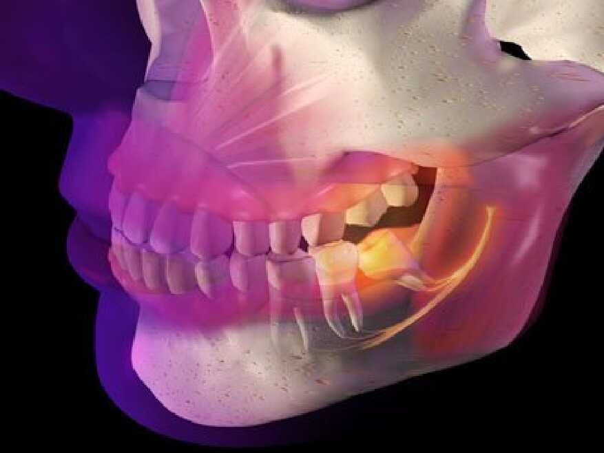 The Teeth Ing Troubles Sore Throat Or Tooth Infection Or A Bigger Problem the-teeth-ing-troubles-sore-throat-or-tooth-infection-or-a-bigger-problem
