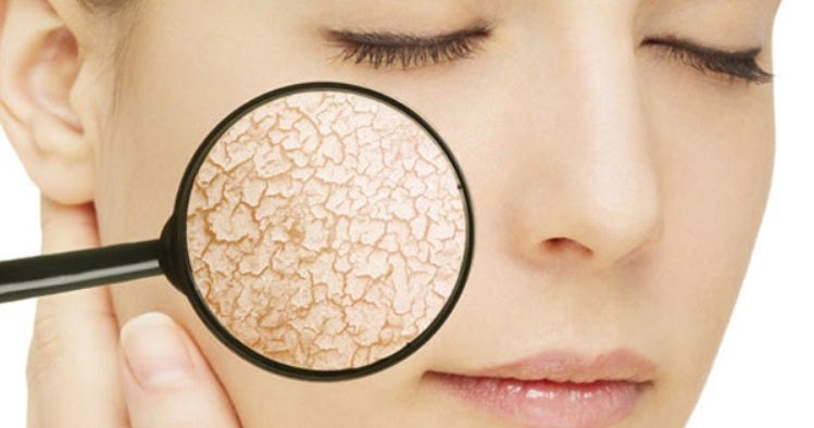 Bagaimana Cara Mengatasi Gatal Pada Kulit Kering? ~ Icha's ...