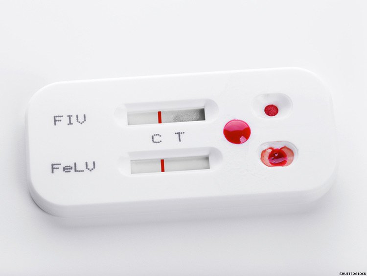 Living with HIV and other LGBTQ Issues!! 🏳️‍🌈 ️ HIV SelfTest Kits Are