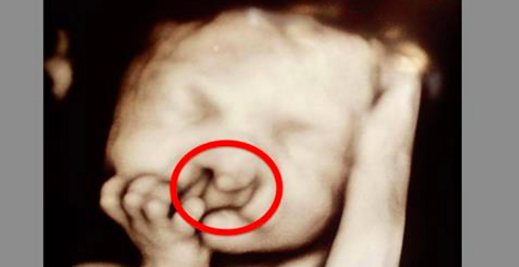 Les médecins voient la tête du bébé à l'échographie et ne disent plus rien. Mais quand ils parlent aux parents, c'est la surprise!
