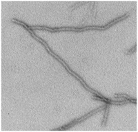 Amyloid fibres. Source: PLoS Biology, doi:10.1371/journal.pbio.1001346