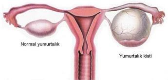 kisiseldoktor blogspot com