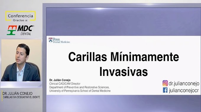 WEBINAR: Carillas Dentales sin desgastar el diente - Dr. Julián Conejo