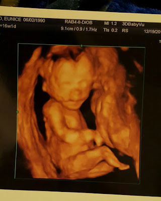 16 haftalık gebelik görüntüsü