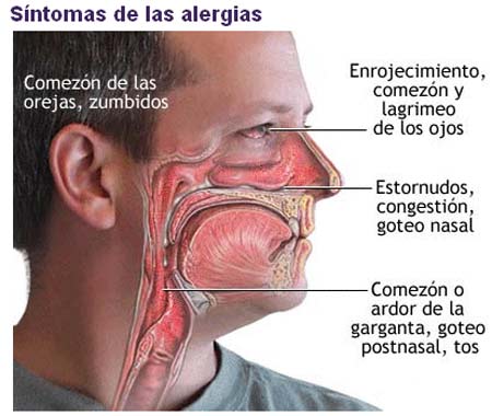 Pequeños remedios congestión nasal Pequeños remedios congestión nasal