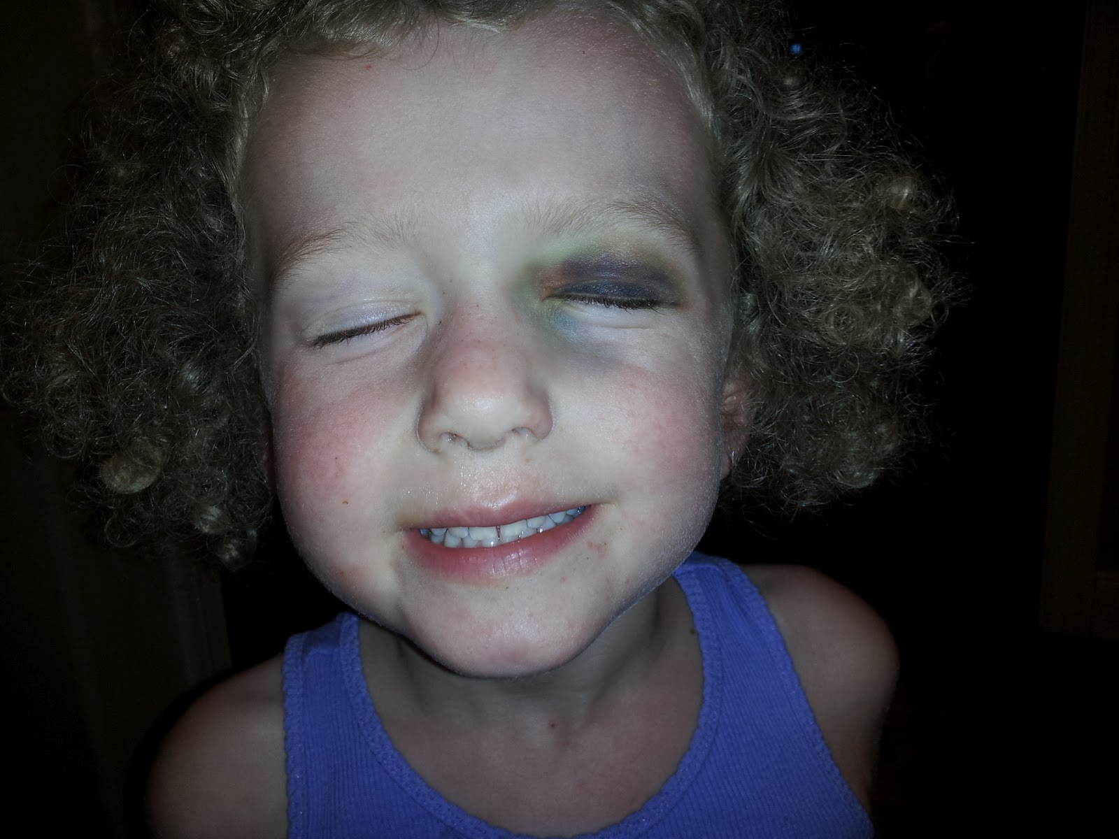 The Adair Edition A black eye and an insight into Heaven