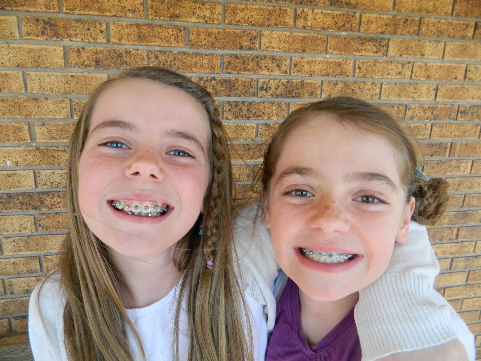 Bullock Family Adventures Braces