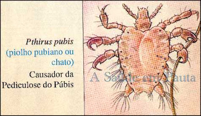 Pthirus pubis, causador da pediculose do pubis ou Ptiríase