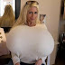 Wow, Wanita Ini Punya Payudara Super Jumbo Seberat 18 Kg