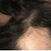 AQUÍ ESTÁ LA POPULAR MARCA CHAMPÚ QUE ESTÁ CAUSANDO PERSONAS A TRAVÉS DE AMÉRICA A PERDER SU CABELLO DURANTE LA NOCHE