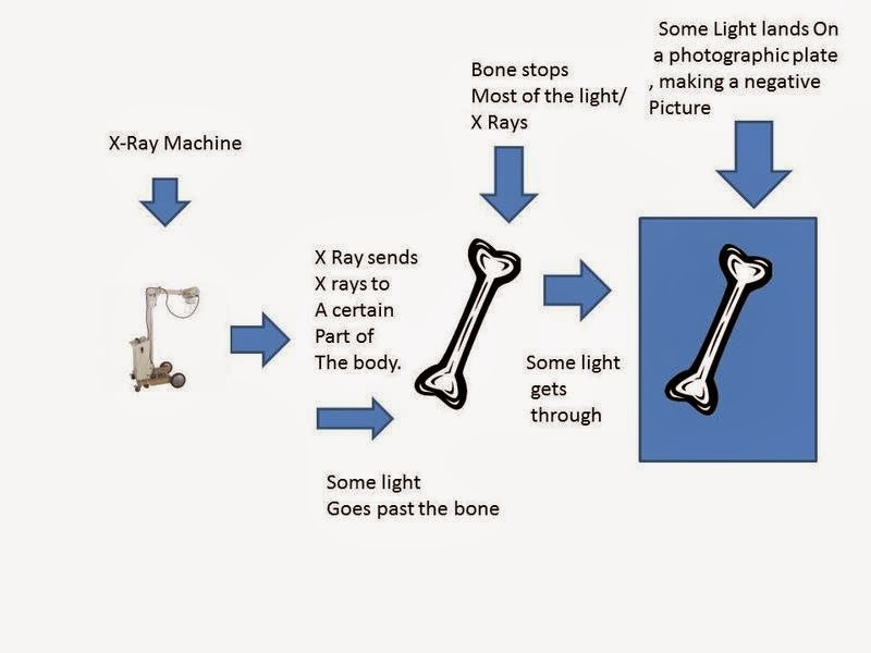 The Xray How It Works
