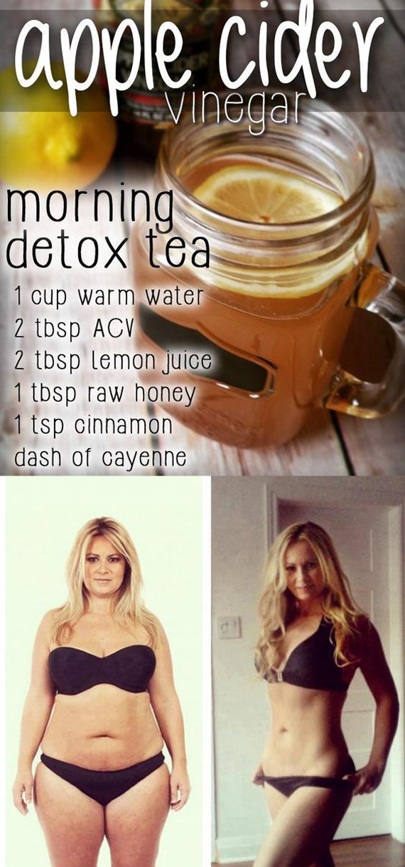 Lose Weight Wisely Apple Cider Vinegar Weight Loss Remedies 7 Reasons