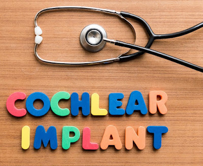 Cochlear Implant Awareness Programme Organized in Haryana