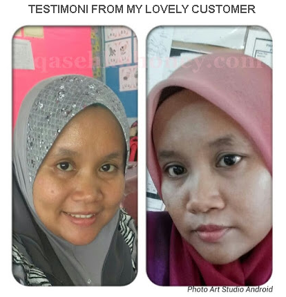 Testimoni Vitamin E Shaklee