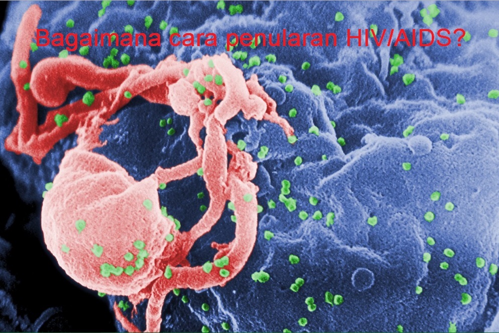 Bagaimana Cara Penularan HIV/AIDS? - Sains Ph.D