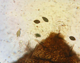 septate hairs of Podospora appendiculata and spore appendages