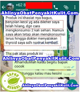 Cara Ampuh Menyembuhkan Gondok Tanpa Operasi Sampai Sembuh Total Cara Ampuh Menyembuhkan Gondok Tanpa Operasi Sampai Sembuh Total