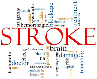 Penyakit Sejenis Stroke, Obat Alami Penderita Stroke Ringan, Mengobati Stroke Dengan Ruqyah, Cara Mengatasi Stroke Ringan Alami, Obat Herbal Stroke Ringan, Cara Mengobati Stroke Iskemik, Obat Stroke Tumbuhan, Tips Mengobati Stroke Secara Alami, Pencegahan Penyakit Stroke Pada Lansia, Cara Pengobatan Tradisional Stroke Ringan, Pantangan Untuk Penyakit Stroke Ringan, Jurnal Penyakit Stroke Hemoragik, Pengobatan Penyakit Stroke Ringan, Cara Cepat Mengobati Stroke Ringan, Penyakit Stroke Bagian Kanan 