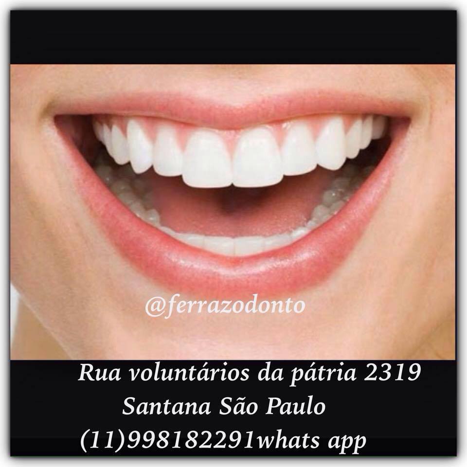 32 tooth. наборы корней зубов. зубы верхней челюсти с корнями. 32 tooth. 32 tooth.