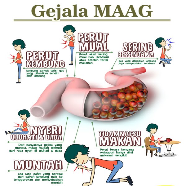 Cegukan, Salah Satu Gejala Sakit Maag yang Tidak Diketahui Orang Cegukan, Salah Satu Gejala Sakit Maag yang Tidak Diketahui Orang