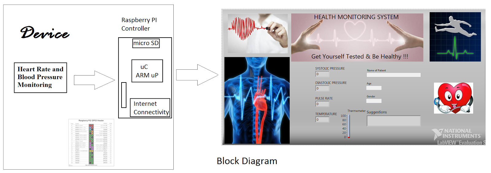 VjSelva HEALTH MONITORING SYSTEM using Raspberry PI & LabView