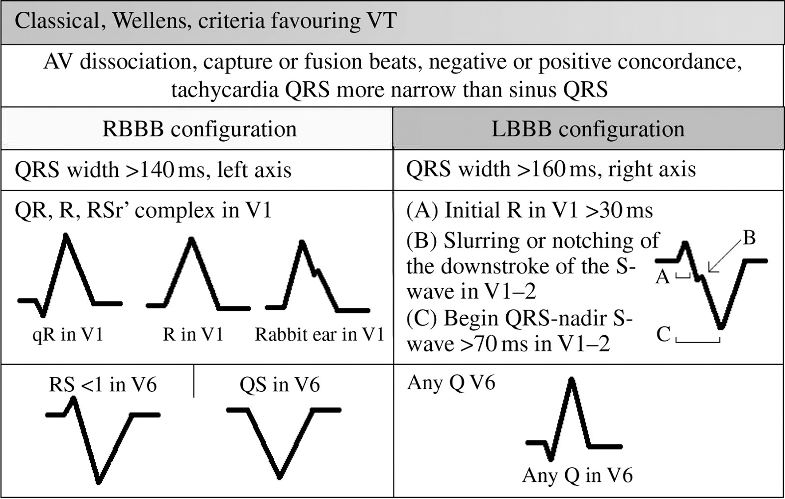 Cardiology window ECG Broad complex tachycardia