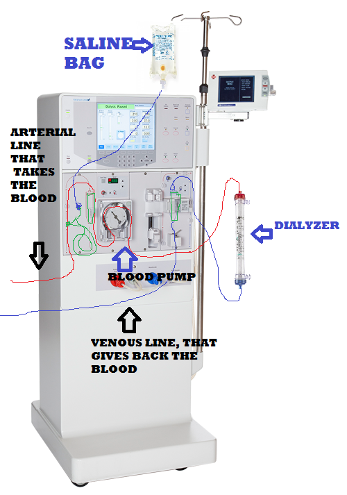 2008t Dialysis Machine Diagram